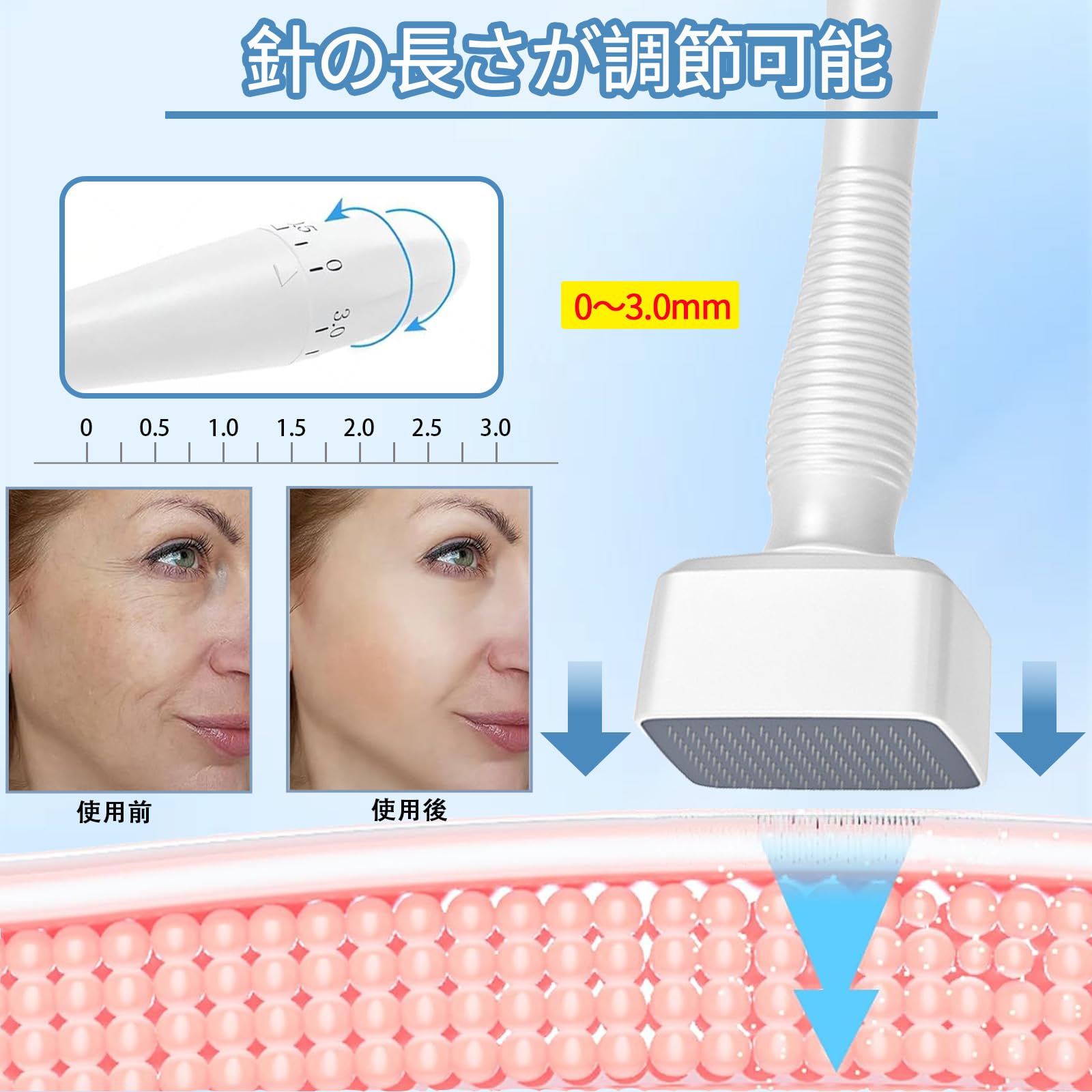 Amazon.co.jp: SrDiot ダーマスタンプ 140針 0-3.0mm調整可能 ダーマ